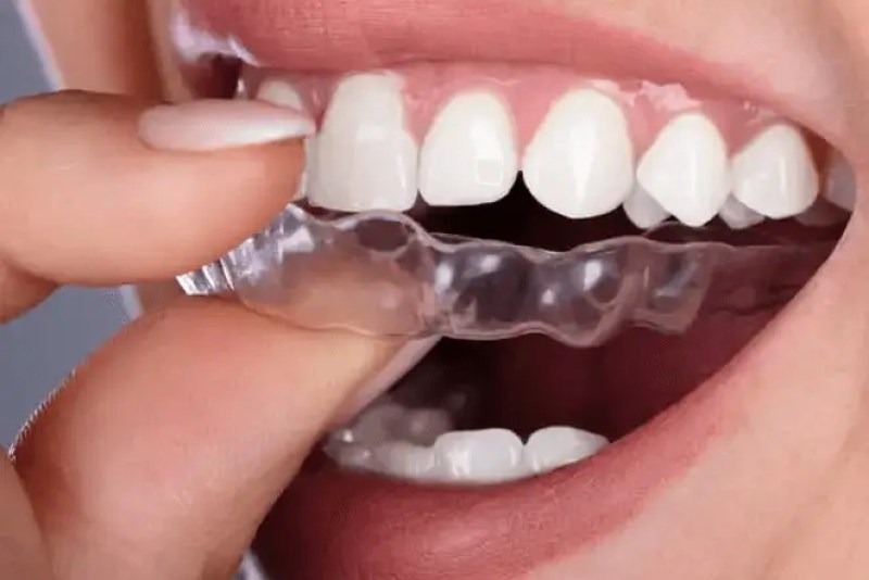 Dentista cerca de mí, dentista cerca de mí, mejor dentista de miami, mejor dentista de miami, pizza cerca de mí, chino cerca de mí, comida cerca de mí, dentista de corona en miami, dentista más barato en miami, dentista de tratamiento de conductos en miami, dentista de tratamiento de conductos en miami más barato