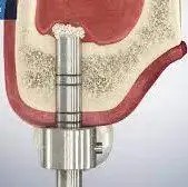 Dentista cerca de mí, dentista cerca de mí, mejor dentista de miami, mejor dentista de miami, pizza cerca de mí, chino cerca de mí, comida cerca de mí, dentista de corona en miami, dentista más barato en miami, dentista de tratamiento de conductos en miami, dentista de tratamiento de conductos en miami más barato